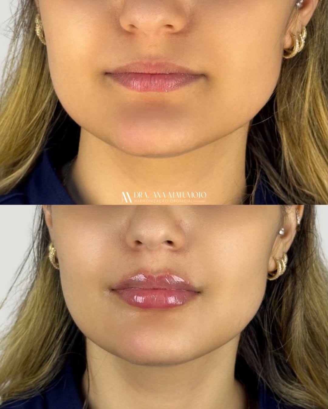 Antes e depois — caso 9